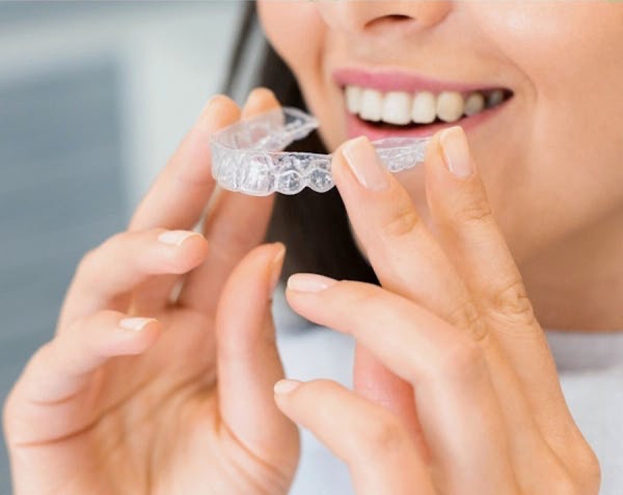 Transparante aligner